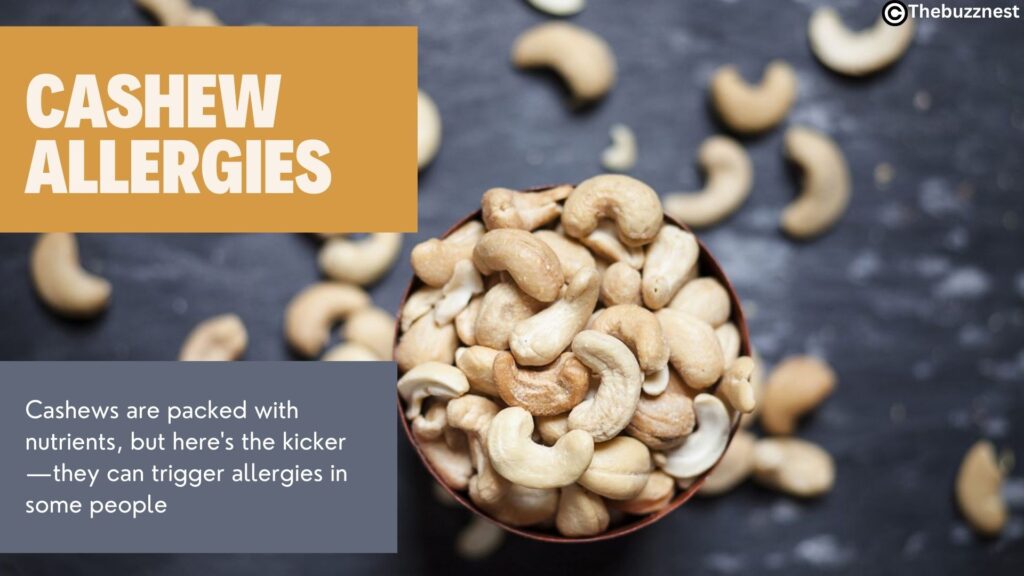 health benefits of cashews